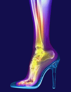 woman_foot_in_stiletto_x_ray_copy_sdpe.gif