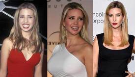 http___cdn.evercoream.com_wp-content_uploads_ivanka-trump-plastic-surgery-before-and-after-photos.jpg