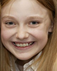 post-40923-0-10517200-1394882910_thumb.j