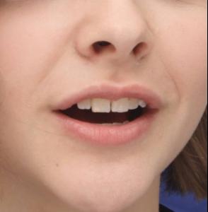 post-40923-0-87752500-1396791178_thumb.j