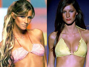 giseleafterboobjob.jpg