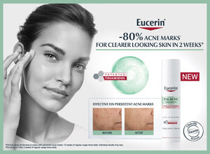 Alpro-Banner-2022_Eucerin_ProAcne_Mobile_6197.jpg