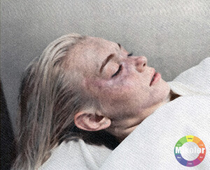 Marilyn body at the morgue in Los Angeles for autopsy after her death on august 5, 1962wmsmall.jpg